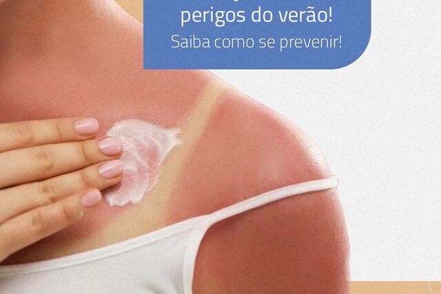 Insolação: um dos perigos do verão! Saiba como se prevenir!