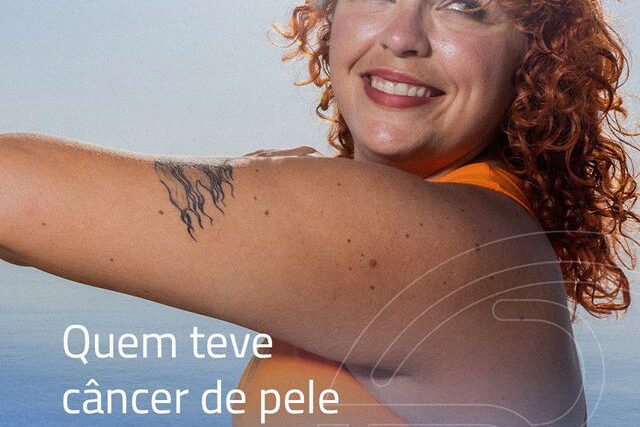 Quem teve câncer de pele pode tomar sol?