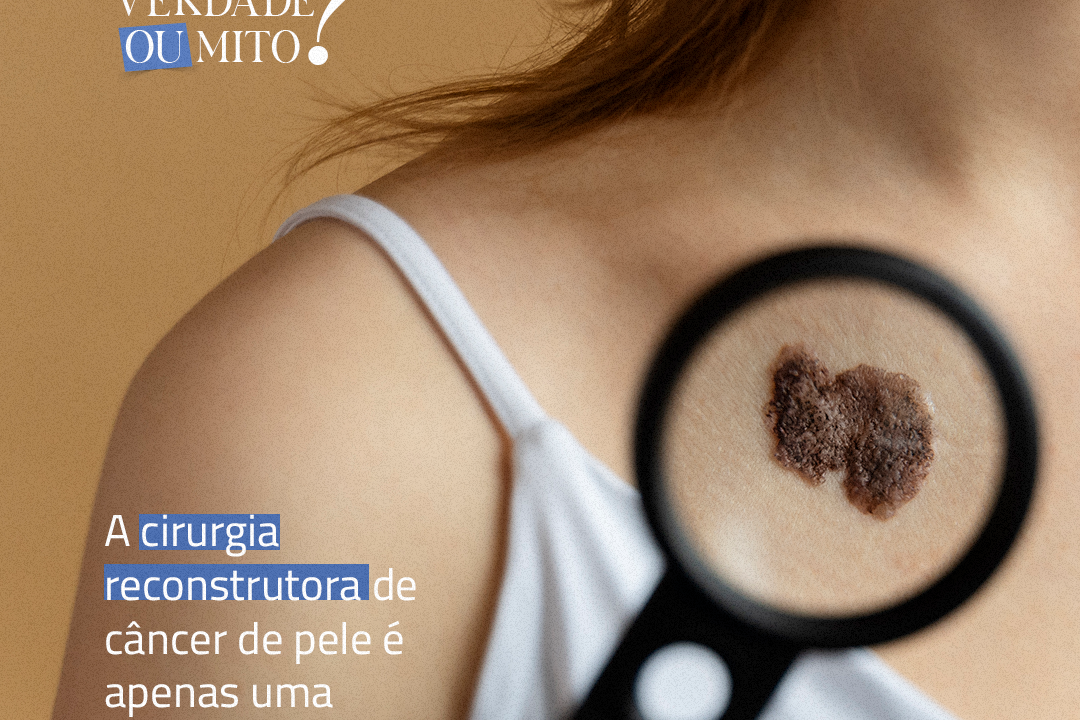 A cirurgia reconstrutora de câncer de pele é apenas uma questão estética?